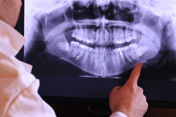 Best Emergency Root Canal Therapy in Skagway, AK