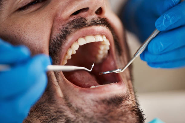 Best Emergency Treatment for Oral Infections in Skagway, AK